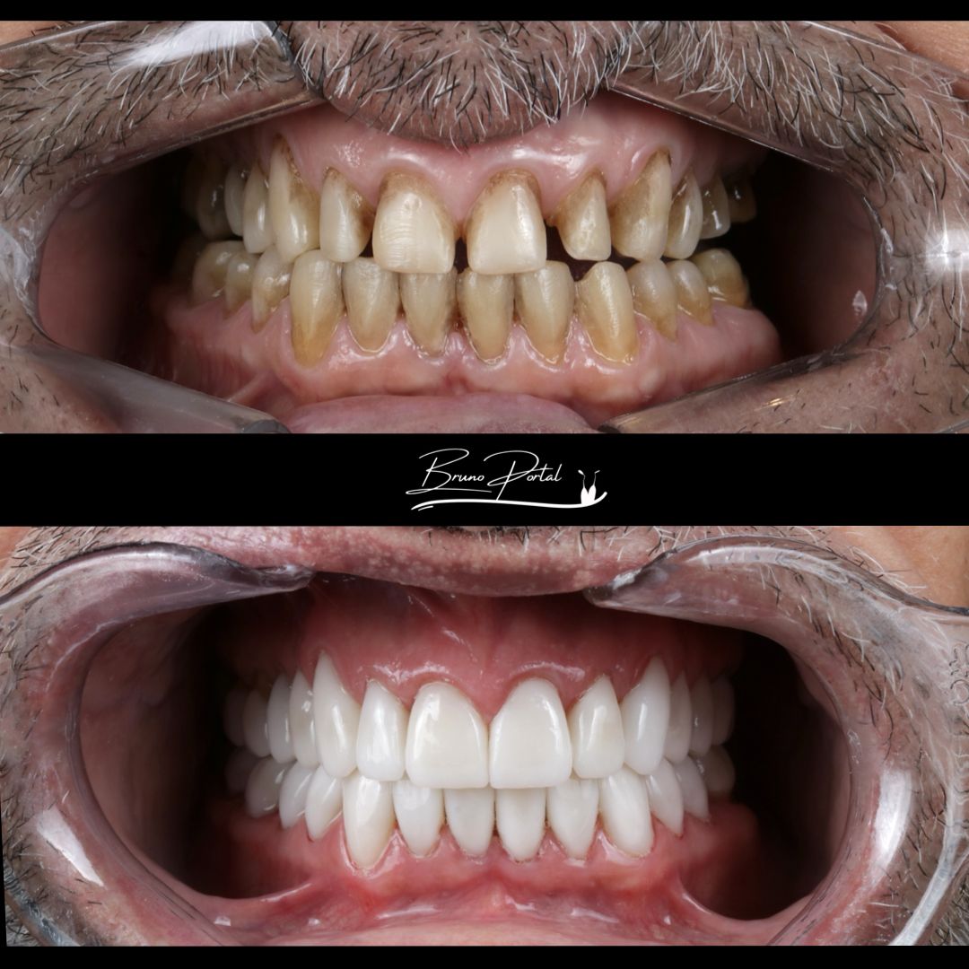 Caso 01: antes e depois