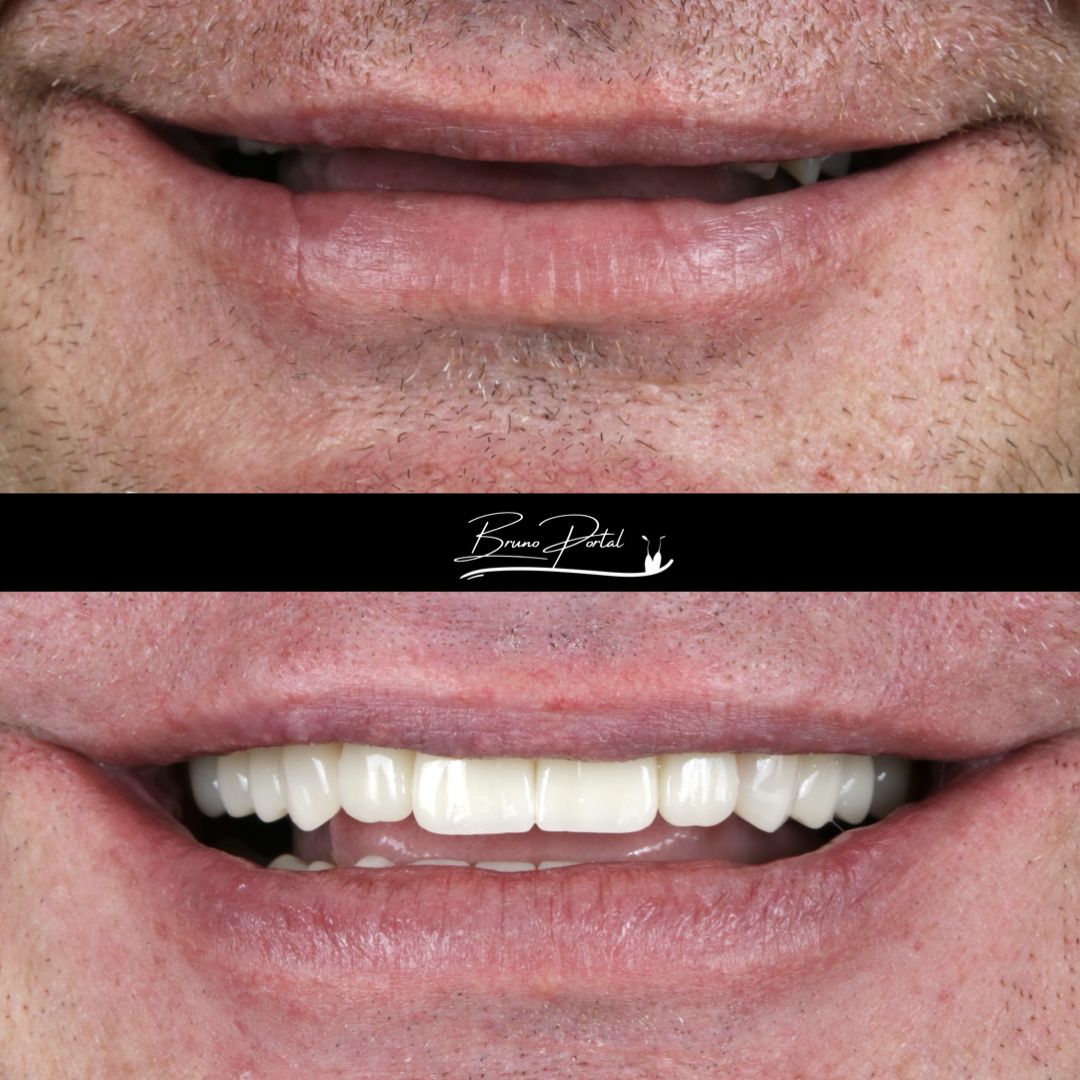 Caso 02: antes e depois