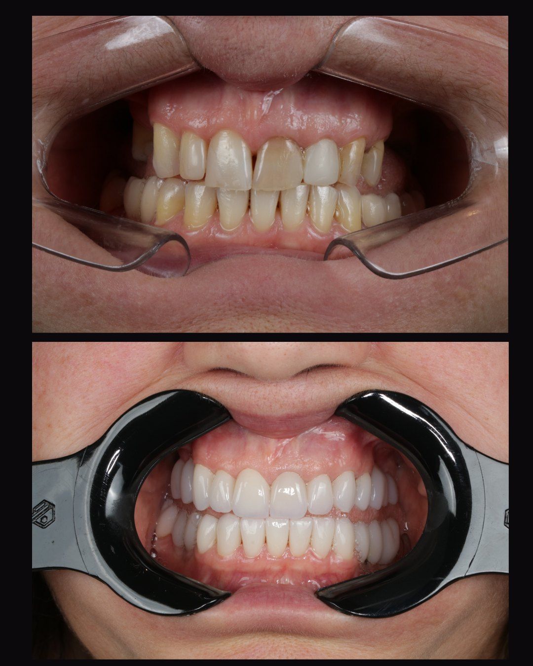 Caso 04: antes e depois