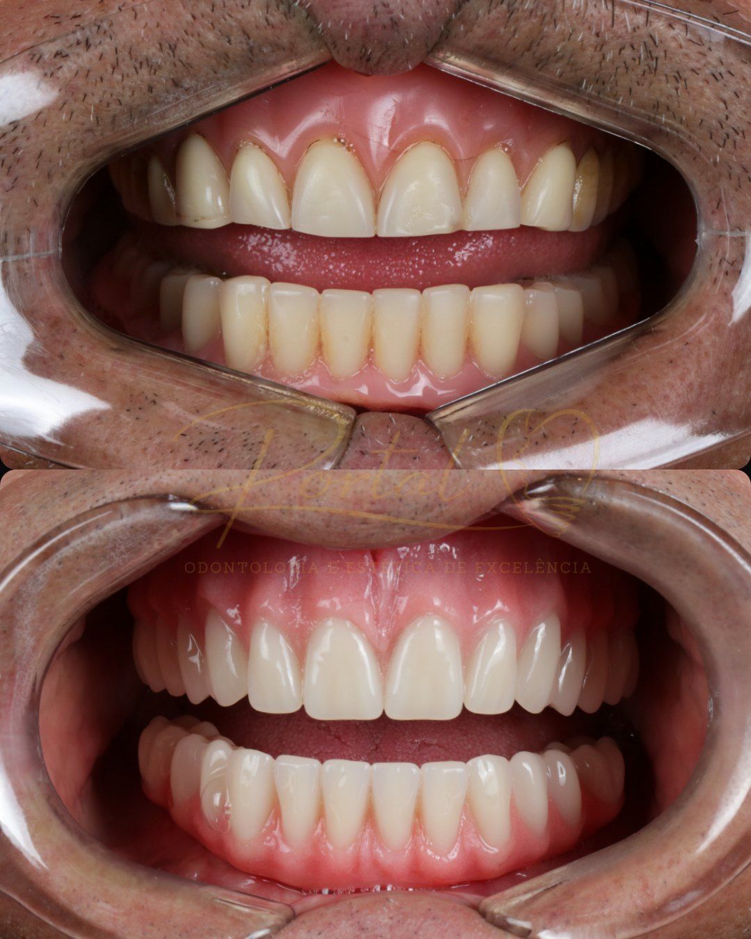 Caso 05: antes e depois